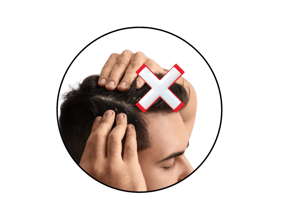 Reduz o ressecamento da pele, caspas e o frizz nos cabelos